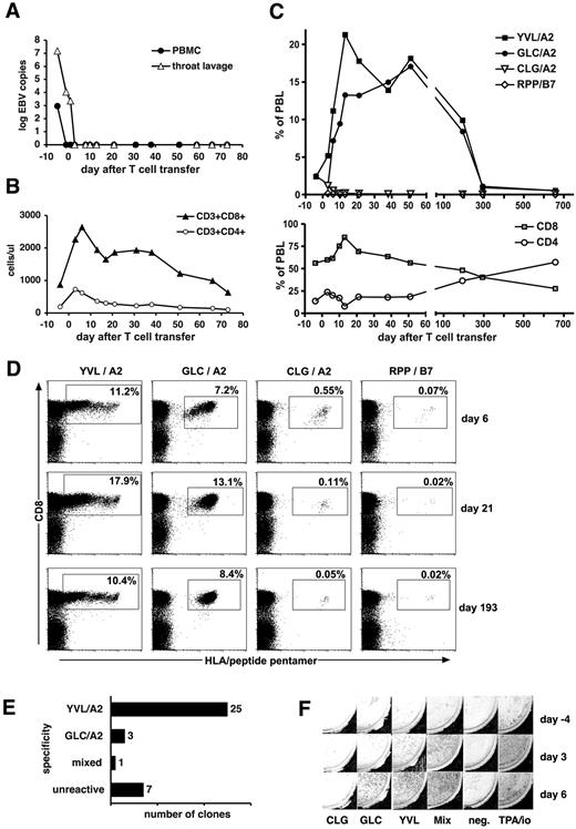 Figure 2. Expansion of EBV-specific T cells in patient 1 after T-cell transfer. (A) EBV DNA levels in peripheral blood cells (copies per 20 000 cells) and in throat lavage fluid (copies per milliliter). (B) Absolute numbers of CD8+ and CD4+ T-cell subsets in peripheral blood. (C) Frequencies of CD8+ T cells specific for EBV epitopes in total peripheral blood lymphocytes (PBLs) were assessed by staining with specific HLA-peptide multimers. Epitopes from immediate-early and early lytic cycle antigens (epitopes YVL and GLC) and from latent antigens (epitopes CLG and RPP) were included in the analysis. (D) Examples of HLA-peptide multimer stainings of PBL samples obtained at 3 different times after adoptive cell therapy as indicated. Cell populations within boxes were counted as multimer-positive. Percentages indicate their proportion in total lymphocytes. (E) Frequencies and specificities of antigen-specific T-cell clones obtained by direct single-cell cloning of PBLs on day 37 after adoptive T-cell transfer. (F) Assessment of interferon-γ–secreting EBV-specific T cells by an ELISPOT assay before (day −4) and after adoptive T-cell transfer (days 3 and 6). PBMCs (200 000 per well) were stimulated, as indicated, with individual EBV peptides (CLG, GLC, YVL), a mix of all 23 peptides, no stimulator (“neg”), or with TPA (12-O-tetradecanoylphorbol-13-acetate) and ionomycin for a positive control.