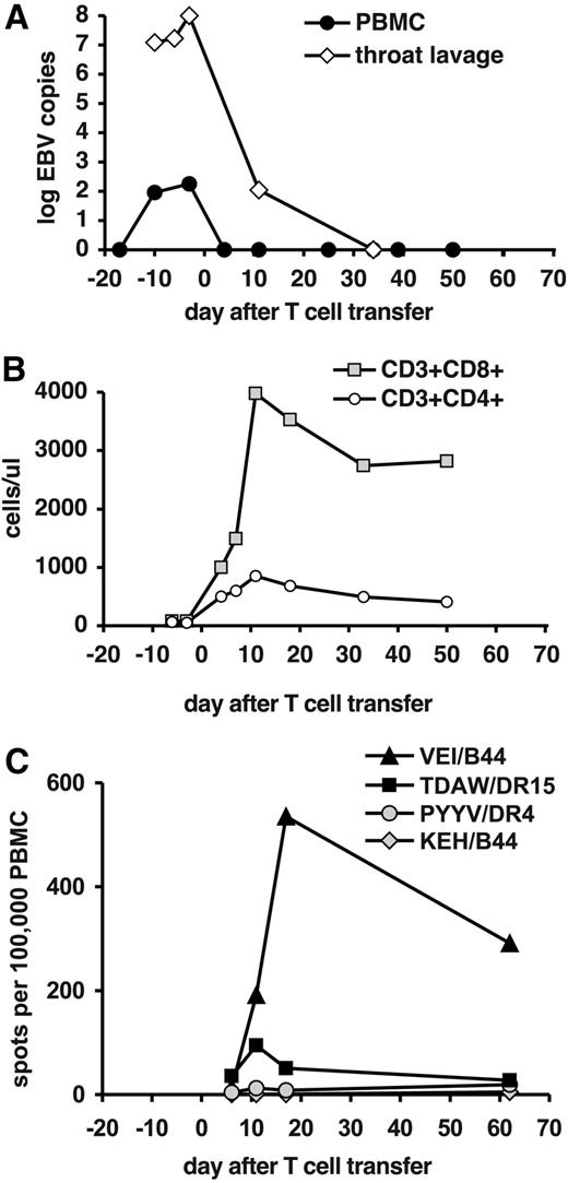 Figure 4. Expansion of EBV-specific T cells in patient 3 after T-cell transfer. (A) EBV DNA levels in peripheral blood cells (copies per 20 000 cells) and in throat lavage fluid (copies per milliliter). (B) Absolute numbers of CD8+ and CD4+ T-cell subsets in peripheral blood. (C) Frequencies of T cells specific for EBV epitopes in total PBLs were assessed by an ELISPOT assay for IFN-γ. Responses against CD8+ T-cell epitopes from latent antigens (epitopes VEI and KEH), a CD4+ T-cell epitope from an early antigen (PYYV), and a CD4+ T-cell epitope from a late antigen (TDAW) were included.