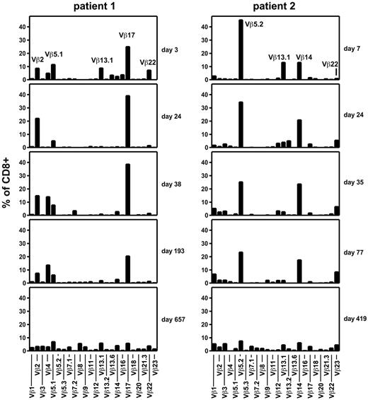 Figure 6. Evolution of the TCR repertoire of CD8+ T cells after transfer of EBV-specific T cells. Peripheral blood samples from patients 1 (left) and 2 (right) were obtained at the indicated times after EBV-specific T-cell transfer and stained with a panel of 24 antibodies specific for individual TCR Vβ domains.