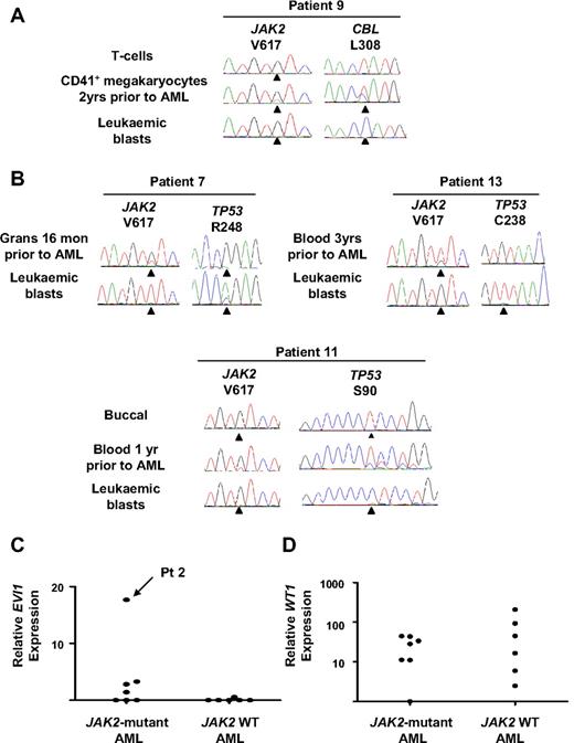 Figure 3. CBL and TP53 mutations and EVI1 and WT1 expression in patients progressing to acute leukemia. (A) CBL mutation in patient 9 showing detection of the mutation in CD41+ megakaryocytes 2 years before AML transformation and loss of the wild-type CBL allele in leukemic blasts. (B) TP53 mutations in 3 patients progressing to acute leukemia showing the presence of the mutation 1 year before transformation in patient 11. (C) EVI1 expression measured by real-time PCR normalized to normal CD34+ cells showing a 17-fold increase in relative EVI1 expression in patient 2. (D) WT1 expression measured by real-time PCR normalized to normal CD34+ cells showing increased transcript levels (>2 standard deviations above the mean of the normal controls) in 6 of 7 JAK2-mutant and 5 of 6 JAK2 wild-type leukemias. Grans indicates purified granulocytes; and mon, months.