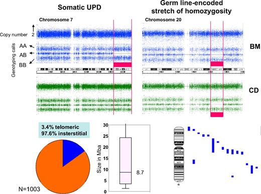 Figure 3. Determination of acquired versus germline nature of CN-LOH. Acquired CN-LOH (red bar, top left) is identified when allelic imbalance (as shown by genotyping calls) with normal copy number (top track) in bone marrow and not CD3+ cells (representing the germline configuration). Top left: An example of acquired CN-LOH of chromosome 7. A region of homozygosity and diploid copy number (as indicated by the red bar) are seen in bone marrow only. Top right: An example of germline CN-LOH of chromosome 20. Runs of homozygosity (red bars) are present in both bone marrow and CD3+ cells. Among a cohort of 1003 healthy controls, CN-LOH was mainly interstitial (bottom left) and ranged in size from 0.3 to 65 Mb (median, 8.7 Mb; bottom center). Bottom right: The distribution of nonclonal, germline CN-LOH in controls on an exemplary chromosome (chromosome 6).