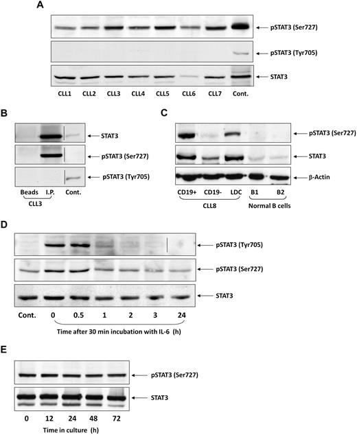 Figure 1. STAT3 is constitutively phosphorylated on serine 727 residues in CLL cells. (A) Cell lysates of patients with CLL (CLL 1-7) and of A549 cells (control) were analyzed by Western immunoblotting using antiserine pSTAT3, antityrosine pSTAT3, or anti-STAT3 antibodies. (B) Cell lysates of CLL patient 3 were incubated with rabbit anti–human STAT3 antibodies for immunoprecipitation (I.P.) with protein A-agarose beads. Incubation of cell lysates with beads only was used as a negative control (beads). The immunoprecipitate was analyzed by Western immunoblotting using antiserine pSTAT3, antityrosine pSTAT3, or anti-pSTAT3 antibodies. 3T3 cells were used as a positive control (Cont.). (C) PB cells of CLL patient 8 were fractioned using immunomagnetic beads. CD19+ and CD19− cells were collected. Normal PB CD19+/CD20+ B cells were purified by immunomagnetic beads. Expression of serine pSTAT3 in CLL low-density cells (LDC), CD19+, and CD19− cells and normal donor B cells (B1 and B2) was analyzed by Western immunoblotting using antiserine pSTAT3, anti-STAT3, or anti–β-actin (loading control) antibodies. (D) CLL cells (CLL 9) were stimulated with IL-6 (50 ng/mL, 30 minutes) or left untreated. The cells were harvested at different time points after IL-6 stimulation. Cell lysates were analyzed by Western immunoblotting using antityrosine pSTAT3, antiserine pSTAT3, or anti-STAT3 antibodies. (E) CLL cells (CLL 10) were cultured in medium for 12 to 72 hours, the cells were harvested, and cell lysates were analyzed by Western immunoblotting using antiserine pSTAT3 or anti-STAT3 antibodies. Vertical lines indicate realignment of the same gel's image.
