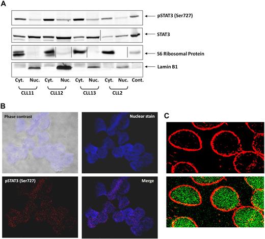 Figure 2. Serine pSTAT3 translocates to the nucleus. (A) Cytoplasmic (Cyt.) and nuclear (Nuc.) fractions were extracted from CLL cells of patients 2, 11, 12, and 13, as described in “Isolation of nuclear and cytoplasmic extracts,” and analyzed by Western immunoblotting using antiserine pSTAT3 and anti-STAT3 antibodies. Adequate fractionation of cytoplasmic and nuclear extracts was confirmed using anti-S6 ribosomal protein and antilamin B1 antibodies. (B) Confocal microscopic images of freshly isolated CLL cells (CLL 14 and 15) that were cytospun and fixed on glass slides, as described in “Confocal microscopy.” As shown (original magnification × 400), the slides were stained with Alexa Fluor 488–mouse antiphosphoserine (serine 727)-STAT3 antibodies (red dots; bottom left corner) and the nuclear stain TOPRO3 (blue; top right corner). Serine pSTAT3 was detected in the nucleus of CLL cells (red dots overlapping blue; bottom right corner). (C) Using a different approach, the slides were stained with antiphosphoserine (serine 727)-STAT3 Alexa Fluor 488–mouse antibodies (green dots) and ribosomal protein S6, followed by phycoerythrin-conjugated rabbit anti–mouse antibodies (red dots). Serine pSTAT3 was detected in the nucleus (green dots) and the cytoplasm (yellow dots represent colocalization of ribosomal protein S6 and serine pSTAT3; X-1000). Vertical lines indicate realignment of the same gel's image. Images were acquired using an Olympus Flowview FV500/X81 system using Flowview software and a 60× oil immersion lens, and cropped and revised using Microsoft Office PowerPoint 2003.