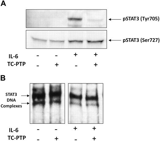 Figure 5. TC-PTP dephosphorylates IL-6–induced tyrosine pSTAT3 but does not affect STAT3-DNA binding. CLL cells (CLL 16 and 25) were incubated for 30 minutes, with or without 50 ng/mL IL-6. Nuclear fractions were extracted and treated with TC-PTP for 30 minutes, as described in “EMSA.” After TC-PTP treatment, nuclear extracts were analyzed by (A) Western blot analysis using antityrosine pSTAT3 and antiserine pSTAT3 to detect the corresponding proteins or (B) EMSA to detect binding of STAT3 to the biotin-labeled DNA probe, as described in “EMSA.”