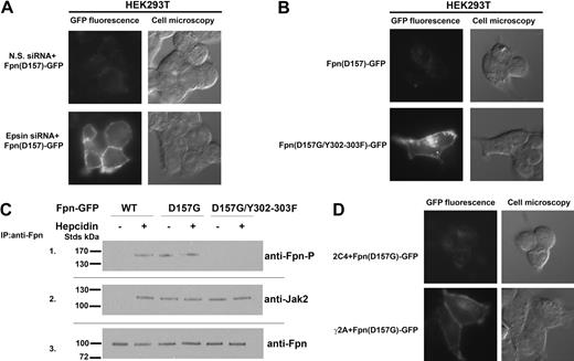 Figure 1. Fpn(D157G)-GFP binds Jak2 and is phosphorylated in the absence of hepcidin. (A) HEK293T Fpn-GFP cells were transfected with nonspecific (N.S.) or epsin-specific siRNA oligonucleotide pools. At 48 hours after silencing, cells were transfected with plasmid containing Fpn(D157G)-GFP. After 18 hours, the presence of Fpn(D157G)-GFP was assessed by epifluorescence. (B) HEK293T cells were transiently transfected with Fpn(D157G)-GFP or Fpn(D157G)/(Y302-303F)-GFP. After 18 hours, the presence of both Fpn-GFP mutants was assessed by epifluorescence. (C) HEK293T cells were cotransfected with plasmids containing Fpn-GFP or DynaminK44A and incubated in the presence or absence of 1.0 μg/mL hepcidin for 30 minutes. Cells were placed at 0°C and solubilized. Samples were immunoprecipitated with rabbit anti-Fpn antibodies as described in “Other procedures.” Immunoprecipitated samples were analyzed by Western blots probed using rabbit anti-Fpn–P (panel 1), rabbit anti-Jak2 (panel 2), or rabbit anti-Fpn (panel 3), followed by a peroxidase-conjugated goat anti–rabbit IgG or peroxidase-conjugated goat anti–mouse IgG. (D) Wild-type (2C4) and Jak2-deficient cells (γ2A) were transfected with Fpn(D157G)-GFP. At 18 hours after transfection, Fpn(D157G)-GFP localization was determined by epifluorescence microscopy.