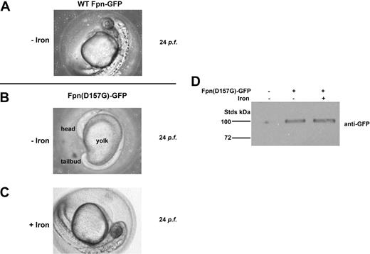 Figure 2. Expression of Fpn(D157G)-GFP in zebrafish results in embryonic iron deficiency. (A) Zebrafish embryos were injected with plasmid containing wild-type Fpn-GFP. (B) Zebrafish embryos were injected with plasmid containing Fpn(D157G)-GFP. At 24 hours postfertilization (hpf), embryo development was analyzed using an Olympus Microscope U-CMAD-Z camera and a 10× objective. (C) Zebrafish embryos were injected with Fpn(D157G)-GFP and with iron-dextran. At 24 hpf, embryos development was analyzed as in panel A. The figures are representative of 5 different experiments in which 200 embryos were injected for each condition. (D) Embryos injected with Fpn(D157G)-GFP with or without iron-dextran were solubilized in lysis buffer, and Fpn-GFP levels were assayed by Western blot analysis.
