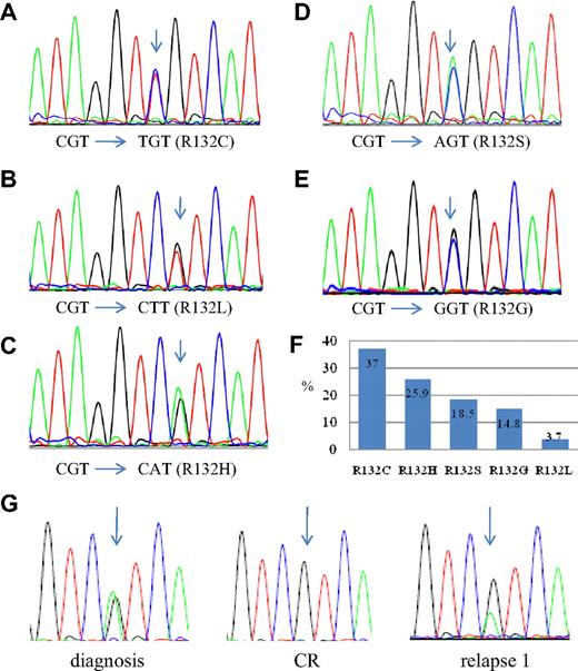 Figure 1. Sequences of IDH1 mutations. (A-E) The 5 types of IDH1 mutation. The arrow indicates the mutated nucleotide. (F) The percentages of each type of mutation. R132C comprises 37% of all types of IDH1 mutation. Only 1 of 27 IDH1-mutated patients (3.7%) has R132L. (G) The sequential study of IDH1 mutation in patient 9. The arrow points to R132H mutation in the patient.