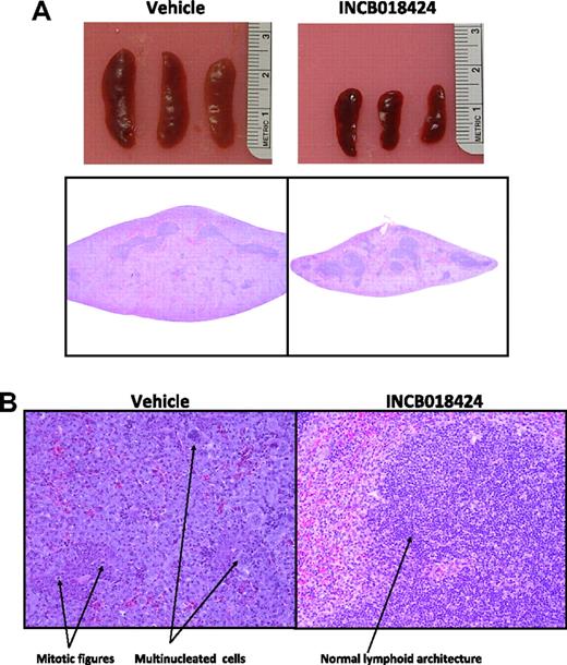 Figure 4. Macroscopic and microscopic effects of INCB018424 on spleens from mice inoculated with Ba/F3-EpoR-JAK2V617F cells. Massive splenomegaly is observed in vehicle-treated mice as assessed by gross appearance (A top) or hematoxylin and eosin-stained transverse sections collected at the midline (A bottom), although markedly reduced with INCB018424 treatment. (B) Microscopic examination (original magnification ×20) of tissue sections shows the massive accumulation of malignant cells in the vehicle group with an abundance of mitotic figures and multinucleated cells present. Treatment with INCB018424 dramatically reduces the malignant cell burden and restores normal lymphoid architecture.