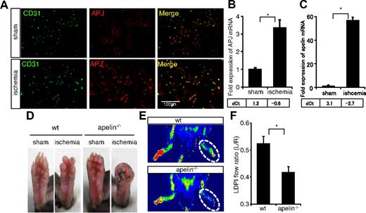 Figure 2. Requirement for endogenous apelin for recovery of hind limb perfusion after induction of ischemia. (A) Immunohistochemical staining of muscle sections from sham-operated (sham) or ischemic (ischemia) hind limb with anti-CD31 (green) and anti-APJ (red) antibodies. (B-C) Quantitative real-time PCR analysis of APJ (B) or apelin (C) mRNA expression in CD31+CD45− ECs or CD31−non-ECs derived from muscle of sham-operated (sham) or ischemic (ischemia) hind limb. Levels were normalized against the level of expression of CD31 as an EC marker. Threshold values for target genes normalized against the level of CD31 (dCt) are shown below the graph. (D) Gross appearance of foot pad from sham-operated (sham) or ischemic WT and apelin−/− mice 14 days after resection of the femoral artery. (E) Representative laser Doppler images of mouse hind limbs from WT or apelin−/− mice 14 days after surgery. Red represents greater flow; and blue, less flow. (F) Quantification of laser Doppler-monitored blood flow measurements. Data are from ratio of ischemic right leg versus nonischemic left leg in mice (n > 10). *P < .01.