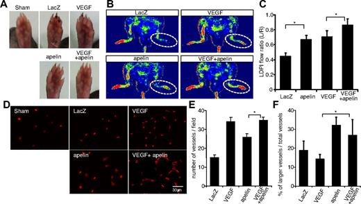 Figure 3. Apelin gene transfer promotes development of larger vessels in the hind limb ischemia model. (A) Gross appearance of foot pad from sham-operated mice (sham) or ischemic mice injected with genes as indicated 14 days after resection of the femoral artery. (B) Representative laser Doppler images of a mouse hind limb 14 days after surgery and gene transfer as indicated. Red represents greater flow; and blue, less flow. (C) Quantification of laser Doppler-monitored blood flow measurements. Data are from ratio of ischemic right leg versus nonischemic left leg mice injected with genes as indicated (n > 10). *P < .01. (D) CD31 staining of quadriceps muscle from mice 14 days after surgery and gene transfer as indicated. Muscle from sham-operated (sham) mice was used for comparison. (E-F) Quantitative evaluation of the vessel number (E) and the percentage of enlarged blood vessels more than 30 μm relative to the total number of blood vessels (F) in mice 14 days after surgery and gene transfer as indicated. *P < .01.