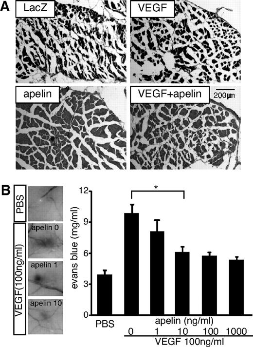 Figure 4. Apelin suppresses VEGF-induced vascular edema. (A) Histologic analysis of hind limb muscles 14 days after resection of the femoral artery and gene therapy as indicated. (B) Miles assay using VEGF and apelin. Left-hand panels: Representative images of the vascular leakage induced by VEGF in the presence or absence of apelin (1 or 10 ng/mL). PBS was used as a negative control. Right-hand panel: Evans blue dye content eluted from dissected skin (mean ± SEM; n = 10). *P < .01.