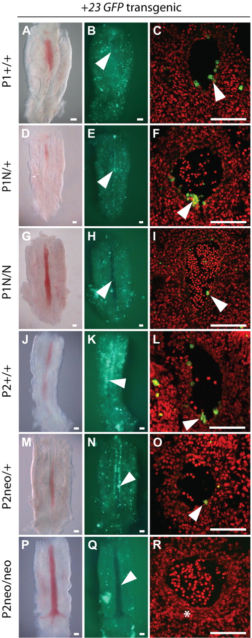 Figure 5. AGM definitive hematopoietic cell emergence shows a greater dependence on P2-Runx1 than P1-Runx1. Panels A, D, G, J, M, and P are representative bright-field images of dissected AGMs of P1 or P2 mutant, +23GFP transgenic compound embryos. Genotypes are as indicated. Panels B, E, H, K, N, and Q are corresponding fluorescent images of dissected AGMs. White arrowheads indicate position of the dorsal aorta. Levels of GFP expression in the aorta are dependent on P1 and P2 genotype. Settings for photomicrographs were identical within the P1 and within the P2 group. Panels C, F, I, L, O, and R are representative images of sections through the AGMs shown, displaying +23-mediated GFP expression in hematopoietic cell clusters (green, examples indicated by white arrowheads). Cell nuclei are shown in red (Topro-3-iodide stained). Total number of embryos analyzed: 2 P1N/N, 1 P1N/+, 2 P2neo/neo, 1 P2neo/+, and 3 wild-type littermates. Scale bar: 100 μm. *Compaction of the mesenchymal cell layers underlying the aorta.