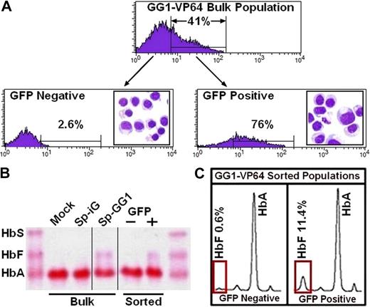 Figure 5. HbF is present only in the transduced fraction of cultured erythroblasts. (A) Fluorescence-activated cell sorting of GFP− and GFP+ fraction of erythroblasts derived from adult-mobilized PB CD34+ cells transduced with SpGG1-VP64 vector where the morphology of sorted cell populations is presented as Wright-stained cytocentrifuge preparations (original magnification ×60) imbedded within histograms for GFP− and GFP+ cell populations, respectively. (B) Hb electrophoresis of lysates from various cell populations (vertical lines have been inserted to indicate a repositioned gel lane). (C) HPLC analysis of lysates from the GFP− and GFP+ cell populations.