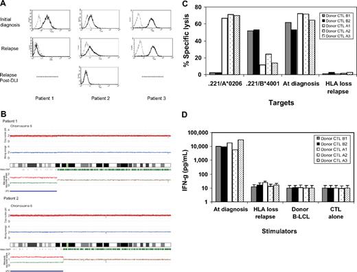 Figure 1. The loss of mismatched HLA expression on leukemic blasts caused by uniparental disomy on chromosome 6p impaired recognition and killing of donor's alloreactive cytotoxic T lymphocytes. (A) Leukemic blasts at the time of initial diagnosis and at the time of relapse after hematopoietic stem cell transplantation (HSCT) and donor lymphocyte infusion (DLI) were gated by CD34+ and CD13+, and then the surface expression of mismatched human leukocyte antigen (HLA) alleles was examined with anti–HLA-A2 antibodies. In 3 patients with acute myelogenous leukemia (AML) who experienced relapse after HLA-haploidentical HSCT, HLA-A2 expression was lost in patient 1 at relapse 15 months after HSCT and lost in patient 2 at second relapse 6 months after DLI. (B) Single nucleotide polymorphism (SNP) array analyses of sorted leukemic cells with the loss of an HLA allele revealed that the short arm of chromosome 6 shows copy number-neutral loss of heterozygosity or acquired uniparental disomy as detected by dissociated allele-specific copy number plots (red and blue lines at the bottom), resulting in the total loss of the mismatched HLA haplotype in both patient 1 and patient 2. The presence of acquired uniparental disomy is also indicated by normal total copy numbers with missing heterozygous SNPs (green bars) in the distal part of the short arm. (C) Recipient alloantigen-specific cytotoxic T-lymphocyte (CTL) clones were generated by a conventional cloning method from cytotoxicity-positive wells obtained in the limiting dilution assays using the donor CD8+ cells as responders. Donor CTL clones A1, A2, and A3 were specific for HLA-A*0206. Donor CTL clones B1 and B3 were specific for HLA-B*4001, all of which recognize mismatched HLA alleles between the donor and recipient. Those 5 representative CTL clones were tested for HLA specificity and recognition of leukemic blasts obtained at the time of the initial diagnosis and at the time of HLA loss relapse after DLI by a standard 51Cr-release assay at the effector/target ratio of 30:1. (D) Their interferon-γ production was also assessed against leukemic blasts collected at the time of diagnosis and at the time of HLA-loss relapse.