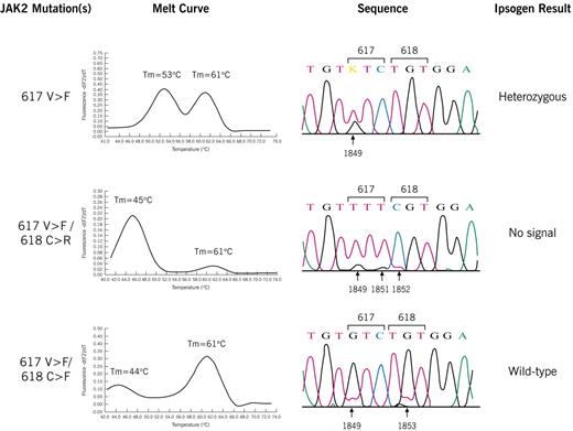 Figure 1. Melt-curve, sequence, and Ipsogen MutaScreen kit results. Results of heterozygous control (top) and patients no. 1 (middle) and no. 2 (bottom). Melting temperatures (Tm) of wild-type and JAK2 mutations are indicated. Sequence analysis of 617V>F heterozygote compared with patients no. 1 (homozygous 617V>F/618C>R; 1849G>T, 1851C>T, 1852T>C) and no. 2 (heterozygous 617V>F/618C>F; 1849G>T, 1853G>T). Using the Ipsogen kit, no signal is obtained in patient no. 1, who is homozygous mutant, due to failure of the mutant probe to bind to the mutant allele. Patient no. 2, who is heterozygous, genotypes as wild-type because the mutant probe does not bind to the mutant allele.