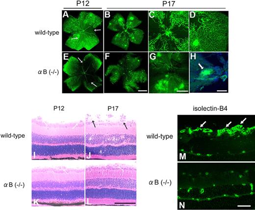 Figure 1. Attenuation of retinal neovascularization in an OIR model with the use of αB-crystallin knockout mice. In (A-H), FITC-Isolectin-B4 angiography in wild-type (A-D) and αB crystallin−/− (E-H) mice at P12 (A,E) and P17 (B-D,F-H) with OIR. At P12, avascular areas identified with arrows. In panel H, the αB−/− flat mount is seen at greater magnification with additional DAPI nuclear staining. Bars indicate 1 mm in panels A, B, E, and F; 200 μm in panels C, D, and G; and 50 μm in panel H. Original magnification, ×50. Images obtained by the use of a confocal microscope (Zeiss) with a 2.5×/0.12 NA (A,B,E,F) and a 40×/1.3 oil immersion NA (C,D,G,H). In panels I-L, hematoxylin and eosin staining in wild-type (I,J) and αB crystallin−/− (K,L) mice at P12 (I,K) and P17 (J,L) with OIR. At P12, occluded existing retinal vessels identified with white arrows. At P17, neovascular tufts identified with black arrows. Bars indicate 100 μm in panels I-L. Original magnification, ×100). Images were obtained by the use of a Spot II digital camera and fluorescence microscope (Leica) with a 20×/0.5 NA. In panels M and N, immunofluorescent staining with isolectin-B4 (green) demonstrates prominent neovascularization (white arrows) in wild-type nice (M) and infrequent neovascularization in αB crystallin−/− mice (N). Bar indicates 50 μm. Original magnification, ×100. Images were obtained by the use of a SpotII digital camera and fluorescence microscope (Leica) with a 40×/0.75 NA lens.