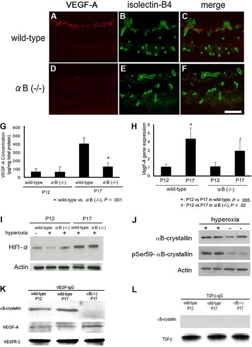 Figure 2. VEGF-A protein expression is reduced in αB-crystallin−/− mice during OIR. In panels A through F, expression of VEGF-A (A,C,D,F; red) and relationship with isolectin-B4+ endothelial cells (B,C,E,F; green) in wild-type (A-C) and αB crystallin−/− mice (D-F) with OIR at P17. Bar indicates 50 μm. Original magnification, ×100. Images were obtained by the use of a SpotII digital camera and fluorescence microscope (Leica) with a 40×/0.75 NA lens. In panel G, VEGF-A protein concentration (pg/mg protein) in posterior eyecup homogenates, determined by ELISA in αB crystallin−/− and wild-type mice with OIR. αB crystallin−/− mice at P17 showed significantly lower concentrations of VEGF-A than wild-type (P < .001) mice. In panel H, VEGF-A mRNA expression determined by real-time PCR analysis and normalized to beta-actin mRNA in posterior eye cups of αB crystallin−/− and wild-type mice with OIR (n = 6). VEGF-A mRNA is up-regulated at P17 in wild-type mice (P < .005) and αB crystallin−/− mice (P < .02). In panel I, Hif-1α protein expression in posterior eyecups with or without hyperoxia at P12 and P17 as measured by Western blot. Hif-1α expression is up-regulated at P17 in wild-type and αB−/− mice. In panel J, αB-crystallin and its phosphorylated serine 59 form in wild-type murine retinas at P12 with or without hyperoxia, as measured by Western blot. Expression of phosphorylated serine 59 form of αB-crystallin is significantly increased in the presence of hyperoxia (n = 3; P < .01). In panel K, Western blot for αB-crystallin, VEGF, and VEGF-R2 in anti–VEGF-A immunoprecipitates from wild-type and αB crystallin−/− mice at P12 and P17 in OIR. αB-crystallin binds to VEGF-A at P12 and P17 in wild-type mice but not in αB crystallin−/− mice. Knockout of αB-crystallin does not affect VEGF-R2 binding to VEGF-A. In panel L, Western blot for αB-crystallin and TGF-β in anti–TGF-β immunoprecipitates of wild-type and αB crystallin−/− mice at P12 and P17 in OIR. There is no apparent binding of αB-crystallin to TGF-β at P12 and P17 in αB crystallin−/− and wild-type mice.