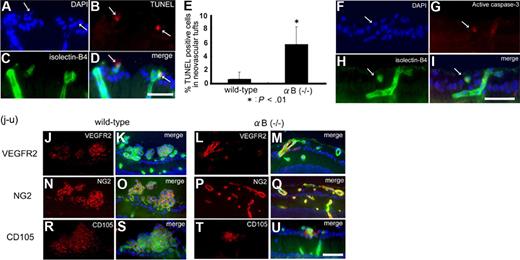 Figure 3. Neovascular endothelial cell apoptosis in αB-crystallin knockout−/− mice in OIR. In panels A-D, DAPI nuclear staining (A; blue), TUNEL staining (B,D; red), and isolectin-B4 endothelial cell staining (C-D; green) in OIR in αB−/− mice at P17. Several TUNEL+ apoptotic cells are detected in neovascular tufts (A-B; arrows), some of which colocalize with isolectin-B4–positive endothelial cells (C,D) on the retinal surface. Bar indicates 50 μm. In panel E, the number of apoptotic cells is significantly greater in αB crystallin−/− mice than that in wild-type mice (P < .01). In panels F through I, DAPI nuclear staining (F), and expression of cleaved caspase-3 (G,I; red), and isolectin-B4 endothelial cells (H-I; green) in αB crystallin−/− mice at P17. Immunoreactivity for cleaved caspase-3 is observed in neovacular endothelial cells (F-I; arrow). Bar indicates 50 μm. Original magnification, ×200. In panels J through U, expression of VEGFR2 (J-M; red), NG2 (N-Q; red), and CD105 (R-U; red) and colocalization with DAPI (blue) and isolectin-B4 (green) in wild-type (J,K,N,O,R,S) and αB crystallin−/− (L,M,P,Q,T,U) retinas in OIR model at P17. Bar indicates 50 μm. Original magnification, ×100. Images obtained with a confocal microscope (Zeiss) with a 40×/1.3 oil immersion NA (C,D,H,I) with SpotII digital camera and fluorescence microscope (Leica) with a 40×/0.75 NA (F,G,J-O).