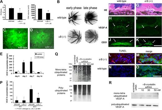 Figure 4. Attenuation of laser-induced CNV in αB-crystallin knockout mice. In panels A-D, CNV was induced by the use of laser photocoagulation and relative FA score and CNV volume measured 14 days after laser. (A) FA score and CNV volume were significantly reduced in αB crystallin−/− (n = 16) compared with wild-type mice (n = 17; P < .02; P < .05; respectively). (B) Representative FA in laser-induced CNV in wild-type and αB crystallin−/− mice at day 14 after laser. (C-D) Representative confocal image of FITC-labeled isolectin-B4–stained flat mounts on day 14. In panel E, VEGF-A concentrations (ELISA in pg/mL) in peripheral blood of wild-type and αB crystallin−/− mice on day 0, 3, 7, and 14 after laser treatment. In panel F-K, histology (hematoxylin and eosin stain), and VEGF-A (arrows) and CD31 (arrows) expression in wild-type (F,H,J) and αB crystallin−/− mice (G,I,K) in CNV lesions 14 days after laser treatment. Bar indicates 50 μm. Original magnification, ×200. In panels L through O, detection of apoptotic cells in CNV lesions by TUNEL assay (red; arrows) and relationship with nuclei (DAPI+ nuclei; blue) and endothelial cells (isolectin B4; green; L-O). Increased numbers of TUNEL+ endothelial cells (arrows) are seen in merged image in αB crystallin−/− mice (L-M; arrows). Bar indicates 50 μm. Original magnification, ×200. In panel P, VEGF concentrations (ELISA in pg/mL) in supernatants of cultured RPE cells exposed to serum-free medium for 48 hours. VEGF concentrations are significantly lower in αB crystallin−/− mice than that in wild-type mice (*P < .01). In panel Q, mono-tetra ubiquitinated proteins are prominent in RPE cells transfected with αB-crystallin siRNA compared with controls; however, polyubiquitinated proteins are similarly prominent after αB-crystallin siRNA treatment and in controls. In panel R, mono-tetra ubiquitinated VEGF-A and polyubiquitinated VEGF-A were detected by Western blot of ubiquitinated proteins by the use of anti-VEGF-A antibody. Images were taken with a SpotII digital camera and fluorescence microscope (Leica) with a 40×/0.75 NA (A-D,F-I) and 20×/0.5NA lens (J-U).