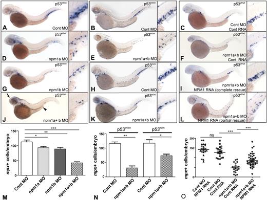 Figure 2. Knockdown of npm1a and npm1b leads to loss of myeloid cells. (A-L) WISH for mpx in 48-hpf embryos, lateral view, anterior to the left, dorsal upwards. (A,D,G,J,M) Knockdown of npm1 genes results in loss of mpx-expressing myeloid cells. A significant difference is seen in myeloid cell numbers when each gene is knocked-down individually (npm1a in panel D and npm1b in panel G, quantified in panel M); this effect is at least additive in the double knockdown (npm1a + npm1b in panel J, quantified in panel M). (B,E,H,K,N) mpx expression is reduced upon npm1 knockdown compared with controls in both the p53wt/wt (B,E) and p53m/m (H,K) backgrounds (quantified in panel N). (C,F,I,L,O) Loss of mpx expression by knockdown of npm1 (F) can be rescued completely (I) or partially (L) by NPM1 RNA injection (10 pg). No differential expression of mpx is observed when 10 pg NPM1 or 10 pg control RNA (C) are injected with a control MO (quantified in panel O). npm1a MO indicates 5′UTR MO (1.4 ng); npm1b MO, 5′UTR MO (1.4 ng); npm1(a+b), npm1a MO + npm1b MO (1.4 ng each); control MO, npm1a 5-bp mismatch + npm1b 5-bp mismatch at 1.4 ng each. Error bars represent SEM. ns indicates not significant; *P < .02; **P < .01; ***P < .001 (Student t test). Complete rescue in panel I is defined as mpx+ cell numbers per embryo greater than the lower limit of the 95% confidence interval of the control RNA/control MO-injected embryos. Partial rescue in panel L is defined as mpx+ cells/embryos greater than the upper limit of the 95% confidence interval of the npm1(a+b) MO but below the lower limit of the 95% confidence interval of the control RNA/control MO-injected embryos.