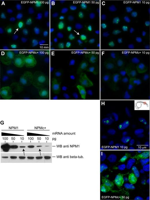 Figure 3. Mutated human NPM1 is aberrantly expressed in the cytoplasm of zebrafish cells. (A-F) Epifluorescence analysis of EGFP-NPM1 (A-C) and EGFP-NPMc+ (D-F) subcellular localization in cytospins of zebrafish cells after mRNA injection at the indicated amounts. NPM1 or NPMc+ proteins are shown in green, and nuclei are counterstained in blue with DAPI. Cells were visualized with a Zeiss Axio imager Z1 microscope using a Zeiss 63×/1.4 numeric aperture (NA) Apochromat oil lens (Carl Zeiss). Images were acquired with Openlab software (Perkin Elmer). (G) WB analysis of protein extracts from NPM1 (top left 3 lanes) and NPMc+ (top right 3 lanes) mRNA-injected embryos. NPM1 expression levels at each mRNA dose are shown along with β-tubulin expression as a loading control (bottom row). The arrows indicate the doses used for subsequent experiments. (H-I) Confocal microscopy of EGFP-NPM1 subcellular localization in zebrafish embryos at 24 hpf injected with 10 pg of EGFP-NPM1 mRNA (H) and 50 pg EGFP-NPMc+ mRNA (I). NPM1 protein is shown in green, while nuclei are counterstained in blue with DAPI. Images of cells were taken in the dorsal trunk region, shown in the insert (H), with a Zeiss LSM 510 META 2-Photon confocal microscope (Carl Zeiss), using a Zeiss 63×/1.4 NA Apochromat oil lens (Carl Zeiss). Images were acquired with the Zeiss LSM 510 software (Carl Zeiss). The EGFP expression patterns shown were representative of cells throughout the embryo.