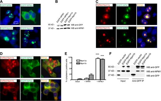 Figure 4. Zebrafish npm1 orthologs interact with human NPM1 protein. (A) Epifluorescent images of 293T cells transfected with pEGFP-C1 expression vector encoding NPM1 (top left), NPMc+ (top right), Npm1a (bottom left), or Npm1b (bottom right). Expressed proteins are shown in green; nuclei are counterstained in blue with DAPI. (B) Anti-GFP WB analysis of protein lysates from transfected cells shown in Figure 2A. Levels of transfected proteins (top row) are shown along with levels of endogenous NPM1 (bottom row). (C) Epifluorescent images of 293T cells cotransfected with pEGFP-C1-NPM1 and pDsRed-monomer-C1 encoding zebrafish Npm1a (top row) or Npm1b (bottom row). Colocalization areas between Npm1a or Npm1b (in red, left column) and NPM1 (in green, middle column) are shown in yellow in the merged images (right column). Nuclei are counterstained in blue with DAPI. (D) Epifluorescent images of 293T cells cotransfected with pEGFP-C1-NPM1c+ and pDsRed-monomer-C1 encoding Npm1a (top row) or Npm1b (bottom row). Colocalization areas between Npm1a or Npm1b (in red, left column) and NPMc+ (in green, middle column) are shown in yellow in the merged images (right column). Nuclei are counterstained in blue with DAPI. All fluorescent images were acquired with a Zeiss Axio imager Z1 microscope using a Zeiss 63×/1.4 NA Apochromat oil lens (Carl Zeiss) and Openlab software (Perkin Elmer). (E) Quantification of the Npm1a and Npm1b delocalization by NPMc+. Bars indicate the percentage of cells with aberrant Npm1a (□) or Npm1b (▧) cytoplasmic expression (with or without residual nucleolar positivity). Error bars indicate SD. *Statistically significant differences between the NPMc+-injected and both NPM1-injected and uninjected embryos (***P < .001; Student t test). More than 200 cells were counted in 3 different microscopic fields for this analysis. (F) Anti-GFP coimmunoprecipitation assays of 293T cells transfected with the empty pEGFP-C1 vector, pEGFP-C1-Npm1a, or pEGFP-C1-Npm1b. Left panels, input; right panels, anti-GFP coimmunoprecipitation lanes. Top row: anti-GFP WB, detecting EGFP-Npm1a and EGFP-Npm1b fusion proteins. Middle row: anti-NPM1 WB, detecting endogenous NPM1. Bottom row: anti-GFP WB, detecting EGFP expressed by the empty vector. In the anti-GFP immunoprecipitation lanes, a dimmer band under the EGFP-Npm1a and EGFP-Npm1b bands probably represents a degradation product of the fusion protein, as it is also visible in the input lanes at longer exposures.