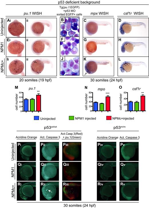Figure 6. NPMc+ expression causes an increase in the number of primitive mpx+ and csf1r+ cells in the absence of functional p53 and causes p53-dependent apoptotic cell death. (Ai-Aii, Ei-Eii, Ii-Iii, M) pu.1 WISH assays in homozygous p53 mutant embryos at 20 somites (19 hpf), uninjected (Ai-Aii), or injected with NPM1 10 pg (Ei-Eii) or NPMc+ 50 pg (Ii-Iii). Embryos are shown in ventral (Ai,Ei,Ii; anterior to the top) and lateral (Aii,Eii,Iii; anterior to the left, dorsal upwards) views. pu.1-expressing cells are indicated by dark purple spots and are increased in embryos injected with NPMc+, 50 pg (Ii-Iii). (M) pu.1+ cell number quantification shows a statistically significant increase upon NPMc+ expression (20 embryos counted per condition). (B,F,J) Giemsa stain of cystospins of EGFP+ cells sorted from Tg(pu.1:EGFP) embryos at 30 somites (24 hpf), injected with p53 MO 1.6 ng alone (B) or in combination with either NPM1 10 pg (F) or NPMc+ 50 pg (J). NPMc+ expression results in larger cells with more immature morphology (J). Images were acquired with a Zeiss Axio imager Z1 microscope using a Zeiss 63×/1.4 NA Apochromat Oil lens (Carl Zeiss) and Openlab software (Perkin Elmer). (C-D, G-H, K-L, N-O) mpx (C,G,K) and csf1r (D,H,L) WISH are shown in lateral views (anterior to the left, dorsal upwards) of homozygous p53 mutant embryos at 30 somites (24 hpf) uninjected (C-D) or injected with NPM1 10 pg (G-H) or NPMc+ 50 pg (K-L). Note that mpx and csf1r expression is markedly expanded upon NPMc+ expression and p53 loss (K-L). The number of mpx and csf1r cells is quantified in panels N and O, respectively (20 embryos counted per condition). Note that the csf1r probe also stains xanthophores in the dorsal trunk of the embryo. Error bars represent SEM. *Statistically significant differences between the NPMc+-injected and both NPM1-injected and uninjected embryos (**P < .005; ***P < .001; Student t test). In histograms, blue indicates uninjected control embryos; green, NPM1-injected embryos; and red, NPMc+-injected embryos. (P-R) Wild-type p53 embryos are shown either uninjected (Pi-Piii), or expressing NPM1 (Qi-Qiii) or NPMc+ (Ri-Riii). All embryos are at 30 somites (24 hpf) and shown in lateral views of the head and anterior trunk, anterior to the left and dorsal upwards. Acridine orange staining (green indicate dead or dying cells) of embryos uninjected (Pi), or injected with NPM1 10 pg (Qi) or NPMc+ 50 pg (Ri) mRNA. An increase in dying cells is observed upon NPMc+ expression (Ri). Activated caspase-3 immunostaining (green indicates cells in apoptosis) of embryos uninjected (Pii), or injected with NPM1 10 pg (Qii) or NPMc+ 50 pg (Rii) mRNA. Increased numbers of apoptotic cells are observed in NPMc+-injected embryos (Rii), forming aggregates on the yolk (arrow). Anti–activated caspase-3 and anti-GFP immunostaining in Tg(pu.1:EGFP) transgenic embryos (red spots indicate cells that express the cleaved form of caspase-3, and green spots indicate cells expressing EGFP under the control of the pu.1 promoter), uninjected (Piii), or injected with NPM1 10 pg (Qiii) or NPMc+ 50 pg (Riii) mRNA. Note in panel Riii the increase in activated caspase-3–expressing cells that surround and lie adjacent to EGFP+ cells, but do not colocalize with them. Homozygous mutant p53 embryos are shown uninjected (Piv-Pv), or expressing either NPM1 (Qiv-Qv) or NPMc+ (Riv-Rv). All embryos are at 30 somites (24 hpf) shown in lateral views of the head and anterior trunk, anterior to the left and dorsal upwards. Acridine orange staining of embryos uninjected (Piv) or injected with NPM1 10 pg (Qiv) or NPMc+ 50 pg mRNA (Riv) show no difference in the number of dead or dying cells. Anti–activated caspase-3 staining of embryos uninjected (Pv) or injected with either NPM1 10 pg (Qv) or NPMc+ 50 pg (Rv) mRNA show no difference in the number of apoptotic cells. Embryos were equilibrated in glycerol and visualized with a Nikon SMZ1500 zoom stereomicroscope (Nikon) using a 488 nm filter for the EGFP signal and 568 nm filter for the red signal. Images were acquired with NIS-Elements software (Nikon).