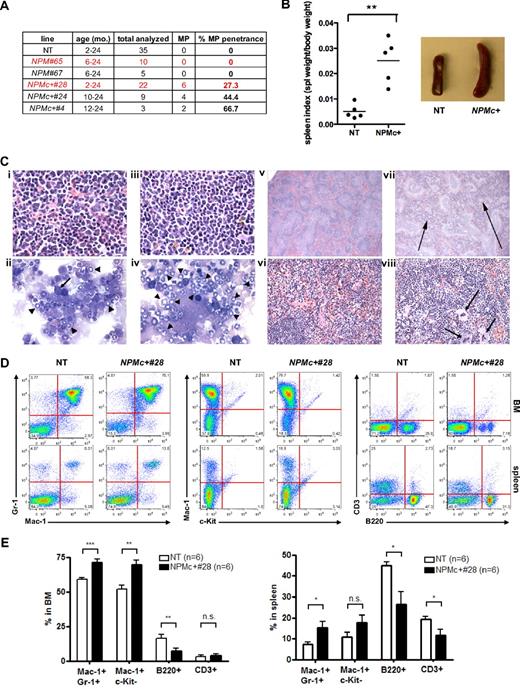 Figure 2. hMRP8-NPMc+ transgenic mice develop a nonreactive myeloproliferation with expansion of mature granulocytes/monocytes. (A) Table showing the total number of mice analyzed from different transgenic lines, their age range, and myeloproliferation (MP) penetrance involving either BM or spleen. (B) Composite data from age-matched littermates of indicated genotypes demonstrating splenomegaly in NPMc+ transgenic mice (mean ± SEM; NT, n = 5; NPMc+ 28, n = 5). **P < .01. Spleen masses are 160 ± 60.8 mg for NT (n = 5) versus 567 ± 284 mg for NPMc+ 28 (n = 5; P = .014). (C) Histopathologic sections of BM and spleen from representative NT and NPMc+ transgenic mice. (i) NT BM (hematoxylin and eosin, original magnification, ×1000). (ii) NT BM cytospin (original magnification, ×1000). represents an erythroblast; , granulocytes. (iii) NPMc+ BM (hematoxylin and eosin, original magnification, ×1000). (iv) NPMc+ BM cytospin (original magnification, ×1000). represent granulocytes. (v) NT spleen (hematoxylin and eosin, original magnification, ×40). (vi) NT spleen (hematoxylin and eosin, original magnification, ×400). (vii) NPMc+ spleen (hematoxylin and eosin, original magnification, ×40). represents areas of expanded red pulp with extramedullary hematopoiesis. (viii) NPMc+ spleen (hematoxylin and eosin, original magnification, ×400). represents extramedullary hematopoiesis. (D) Flow cytometric analysis of single-cell suspensions of BM and spleen from representative NT and NPMc+ transgenic mice demonstrates an increase in granulocytic/monocytic (Mac-1+;Gr-1+) and mature myeloid (Mac-1+;cKit−) cells with a corresponding decrease in the amount of B (B220+) and T (CD3+) lymphoid cell populations. (E) Quantification of granulocytic/monocytic (Mac-1+;Gr-1+), mature myeloid (Mac-1+/cKit+), B cells (B2200+), and T cells (CD3+) in BM and spleen of age-matched NT and NPMc+ transgenic mice analyzed as in panel D (mean ± SEM; NT, n = 6; NPMc+ 28, n = 6). *P < .05. **P < .01. ***P < .001. n.s. indicates not statistically significant.