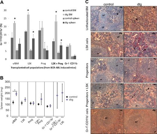 Figure 2. Leukemic granulocytes or progenitors do not initiate or enhance the CML-like disease. Hematopoietic subpopulations were isolated by FACS sorting from BM of 3-week-induced leukemic SCLtTA/BCR-ABL (dtg) and wt or stg control mice. Purification of cell populations was performed according to surface markers expressed by LSK cells, progenitors (Lin−Sca-1−c-kit+), or granulocytes (Gr-1+CD11b+). Recipients were transplanted with 1 × 106 ufBM, 2500 LSK cells, 2500 progenitors, or 3.6 × 105 granulocytes. In addition, LSK cells were added back to additional groups of mice receiving granulocytes or progenitors. Each error bar represents the mean ± SD. (A) The percentage of immature granulocytes (Gr-1low/CD11b+) measured in BM and spleen of mice transplanted with different subpopulations of cells. (B) Spleen weight was unchanged in mice receiving granulocytes or progenitors only. (C) Histologic analyses of spleen were performed by NACE stain. Infiltration with granulocytes and disturbed follicles were only evident in spleens of recipients transplanted with ufBM, LSK cells, or LSK cells added back to granulocytes or progenitors. Slides are depicted at original magnifications of ×10 or ×20. Mice receiving ufBM, LSK, progenitors, or LSK+ progenitors isolated from stg or dtg mice were analyzed between 49 to 55 days after transplantation. Mice receiving granulocytes from dtg or stg donors were analyzed 77 days after transplantation. Recipients of dtg LSK cells or LSK cells plus granulocytes were analyzed 126 days after transplantation. n = 4 each for ufBM, LSK, progenitors, or Gr1+CD11b+ cells. n = 4 (stg) or 3 (dtg) for LSK+ progenitors; n = 3 dtg for LSK and LSK+ Gr1+CD11b+ cells. *P < .05.
