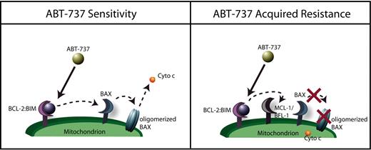 Figure 7. Proposed mechanism of acquired resistance. In sensitive cells, BIM is displaced from BCL-2, inducing BAX activation and apoptosis. In resistant cells, BIM is still displaced, but is captured by BFL-1 and/or MCL-1, preventing BAX activation and maintaining survival.