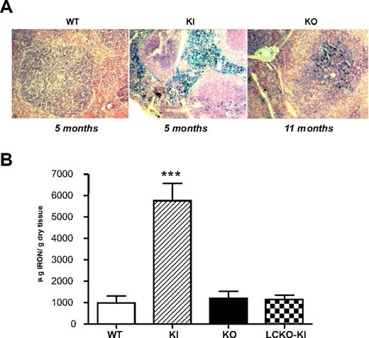 Figure 5. Spleen histology and iron staining. (A) Spleen histology and Perl staining of 5-month-old KI mice compared with aged-matched controls (WT) and 11-month-old KO animals. A Motic BA300 microscope (Mikron Instrument; original magnification ×200) was used with DPX mounting medium and a DPlanApo 20 UV PL, 20×/0.7 NA dry objective (Olympus), captured with a DFC320 (Leica) camera using Leica application suite Version 2.8.1, and processed using Photoshop Version 7.0 (Adobe Systems). (B) SIC in the 3 mouse models at 10 weeks of age. SIC was measured on at least 5 animals for each strain. ***P < .001 versus WT. Bars represent SD in the analyzed animals group.