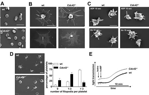 Figure 3. SEM analysis of Cdc42−/− platelets. (A-C) Normal ultrastructure of Cdc42−/− platelets. (A) Resting platelets immobilized on poly-L-lysine. Scale bar equals 5 μm. (B) Spread Cdc42−/− and wild-type platelets upon activation with 0.01 U/mL thrombin on human fibrinogen (100 μg/mL). Top panels show SEM of intact platelets. Bottom panels show visualization of the actin cytoskeleton upon denudation of the plasma membrane. Scale bar equals 2 μm. (C) Morphology of Cdc42−/− and wild-type platelets in suspension at 15 seconds after activation with thrombin (0.1 U/mL; top panels) or ADP (5μM; bottom panels). Scale bar equals 1 μm. (D) Cdc42−/− platelets exhibit reduced filopodia extension upon adhesion on mouse VWF (20 minutes). Left panels show representative images of 5 experiments. Scale bar equals 2.5 μm. Right panel shows statistical evaluation of filopodia formation according to the number of extensions per platelet (0, 1-3, > 3) in 5 different fields corresponding to a total surface of 9215 μm2. The results are mean values ± SD (n = 5 per group). (E) Unaltered agglutination of Cdc42−/− platelets. Washed Cdc42−/− and wild-type platelets were stimulated with botrocetin (5 μg/mL) and human VWF (10 μg/mL) in presence of 40 μg/mL integrilin under stirring conditions and agglutination was monitored over 15 minutes on a Fibrintimer 4 channel aggregometer (APACT Laborgeräte und Analysensysteme). Curves are representative of 3 individual experiments.