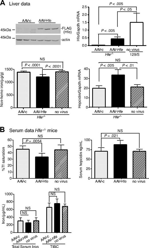 Figure 1. Liver-specific expression of Hfe lowers iron levels, increases hepcidin expression, and lowers Tf saturation in Hfe−/− mice. Hfe−/− mice (n = 3) were injected with AAV-Hfe (5 × 1011 genome equivalents per mouse; ■ in all panels) or with the same amount of AAV-c virus (▩). Two weeks later, the mice were killed. (A) Liver extracts (100 mg) were analyzed by immunoblots with the use of anti–FLAG-M2 antibody or antiactin. Bands were detected by horseradish peroxidase secondary antibodies and enhanced chemiluminescence. Hfe mRNA was determined by quantitative reverse transcription–PCR (qRT-PCR) and normalized to Gapdh. The levels of Hfe mRNA in AAV-c– and in AAV-Hfe–injected Hfe−/− mice were compared with strain-, sex-, and age-matched control wild-type 129/SvTac (129/S) mice (□) with the use of qRT-PCR. Nonheme iron in livers of uninjected Hfe−/− mice () and of AAV-c– and AAV-Hfe–injected Hfe−/− mice is described in “Nonheme iron assay.” Each sample was measured in triplicate. Hepcidin mRNA in Hfe−/− murine liver was determined by qRT-PCR. (B) Serum data. Percentage of Tf saturation was calculated from total serum iron and total iron-binding capacity (TIBC). The latter 2 parameters were measured as described in “Blood iron analysis.” Three to 4 mice were used in each group. All mice were on a 129/S background. The experiments were repeated with 2 more sets of mice with similar results. Error bars represent SD.