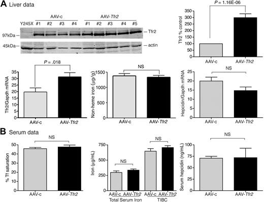Figure 4. Increased expression of Tfr2 in Hfe−/− mice fails to change hepcidin and iron levels. (A-B) An identical protocol was used as outlined in Figure 1. AAV-Tfr2 was injected into Hfe−/− mice. Increased Tfr2 expression in mice injected with AAV-Tfr2 (■) was detected by immunoblot with the use of an antibody to Tfr2 and not in AAV-c (▩) injected mice. Similarly, increased Tfr2 mRNA was detected in the livers of AAV-Tfr2–injected mice. No significant changes in the iron parameters of the liver or serum were detected despite the increased Tfr2 mRNA levels and Tfr2 protein levels. The experiment was repeated once with 4 mice in each group with similar results. Error bars represent SD.