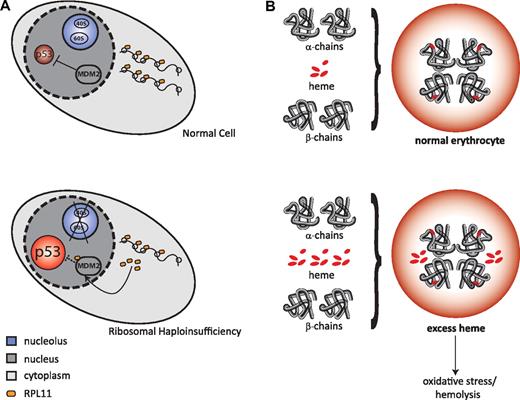 Figure 3. Potential mechanisms for the cellular consequences of ribosomal haploinsufficiency. (A) Top panel: Normal cell in unstressed conditions, with unperturbed ribosome biogenesis and steady levels of p53. Bottom panel: Ribosomal haploinsufficiency leads to up-regulation of rpL11, which binds to MDM2 causing p53 activation, which results in apoptosis and cell-cycle arrest. (B) Top panel: Normal hemoglobin synthesis, with the coordinated production of heme and globin. Bottom panel: Relative excess of free heme leads to oxidative stress and hemolysis through a variety of mechanisms.73