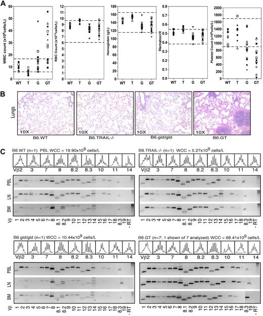 Figure 4. Hematologic assessed of B6.GT mice. (A) Peripheral blood hematology analysis of mouse blood collected from individual B6.WT (n = 7), B6.TRAIL−/− (n = 8), B6.gld/gld (n = 16), and B6.GT (n = 15) mice, more than 20 weeks of age. Blood was collected from freshly killed mice directly from the inferior vena cava into 5 mL potassium K2-EDTA acid-coated blood collection tubes and analyzed within 4 hours of collection on an ADIVA120 Hematology System analyzer. Each symbol differentiates an individual mouse across all hematologic parameters assessed. The normal range of each parameter in mouse blood is shown (dashed lines). (B) Lung histology. Hematoxylin and eosin staining of formalin-fixed paraffin-embedded lung tissues. Shown are sections of lung tissue from 1 representative B6.WT, B6.TRAIL−/−, B6.gld/gld, and B6.GT mouse, and data are representative of repeated analysis of independently generated mouse cohorts. (C) Assessment of T cell and DN T cell clonality as determined by conventional RT-PCR of Vβ-specific TCR CDR3 mRNAs, using RNA obtained from mouse bone marrow (BM), axillary lymph node (LN), and peripheral blood leukocytes (PBL) from a representative mouse 20 weeks of age or older from each strain, or from 7 B6.GT mice. Broad clonality was confirmed using spectratyping analysis on each PCR product. Spectratyping data shown are from PBL TCR Vβ-specific RT-PCR products, with the correlating total white cell counts for the individual mouse, as indicated.