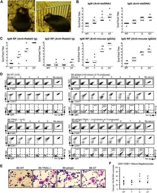 Figure 7. Autoantibody production in B6.GT mice. (A) Spontaneous autoimmune skin lesions and ear pinna erosion in old B6.GT mice. (B) IgM and IgG anti–double-stranded DNA-specific autoantibodies in serum from 5 age-matched female B6.WT, B6.TRAIL−/−, B6.gld/gld, and B6.GT mice. Shown are endpoint titers of individual mouse sera (●) and mean autoantibody levels (horizontal line) of 5 mice per strain. (C) IgM and IgG rheumatoid factor antibodies: anti–rabbit Ig, or anti–mouse IgG2a antibodies, determined by standard ELISA, on serum from 5 age-matched female B6.WT, B6.TRAIL−/−, B6.gld/gld, and B6.GT mice. Endpoint titers (●) and mean autoantibody levels are shown (horizontal line). (D) FACS analysis of B6.WT platelet-bound IgG and IgM autoantibodies in K2EDTA-anticoagulated serum obtained from old B6.WT (n = 5), B6.TRAIL−/− (n = 5), B6.gld/gld (n = 10 shown of 15 analyzed), or B6.GT mice (n = 10 shown of 15 analyzed). Serum antiplatelet antibody capacity to block detection of CD41 and CD61 is also shown. Log scale SSC/FWD scatter platelet events were gated to exclude 99.9% of electronic noise. (E) Visualization of megakaryocytes in Wright Giemsa-stained bone marrow smears. Scale bar represents 50 μm. (F) Enumeration of CD41hiCD61hi bone marrow megakaryocytes per 100 000 bone marrow leukocytes as determined by flow cytometry. Data are individual bone marrow megakaryocytes per pair mouse femurs (●), and means of bone marrow megakaryocytes from 5 mice per strain (horizontal line), calculated from CD41 versus CD61 dot plots of FWD-area large cells (< 0.5% events), pregated for singlet cells determined from FWD-height versus FWD-area dot plots (supplemental Figure 3). No statistically significant differences were found between any strains by 1-way analysis of variance.