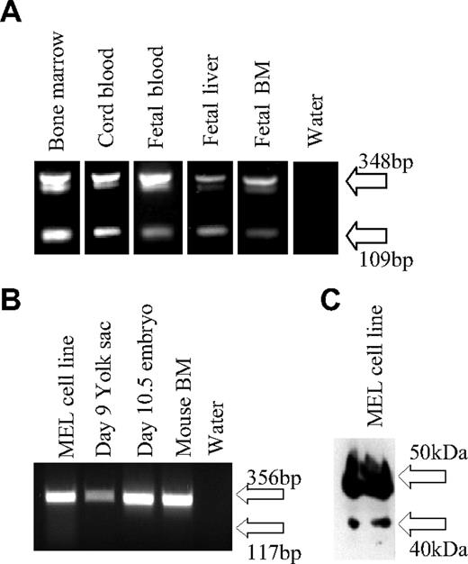 Figure 1. GATA-1 mRNA alternative splicing in human and murine tissues. (A) Reverse transcription–polymerase chain reaction (RT-PCR) of cDNA from human bone marrow, cord blood, and second-trimester (15 weeks) fetal blood, liver, and bone marrow, the expected size of the exon 1/2/3 splice variant (348 bp) and an exon 1/3 splice variant (109 bp) are marked. (B) RT-PCR of cDNA from murine hematopoietic tissues and the erythroleukemia cell line MEL. The expected size of an exon 1/2/3 splice variant (356 bp) and an exon 1/3 splice variant (117 bp) are marked. (C) Western blot of a MEL nuclear extract using M20 GATA-1 antibody (Santa Cruz Biotechnology), the predicted size of GATA-1FL is 47 kDa and GATA-1s 40 kDa.