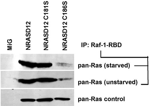 Figure 5. Palmitoylation-defective NRASD12C181S retains the ability to bind Raf-1-RBD. RAS-GTP precipitated with glutathione-agarose beads bound with GST-fused RAS-binding domain (residues 1-149) of Raf-1 from serum-starved or unstarved NIH3T3 cells expressing GFP alone, NRASD12, nonpalmitoylable NRASD12C181S, or nonprenylable NRASD12C186S were analyzed by Western blotting with an anti–pan-RAS (RAS10) antibody. RAS from the same lysates was probed as a loading control.