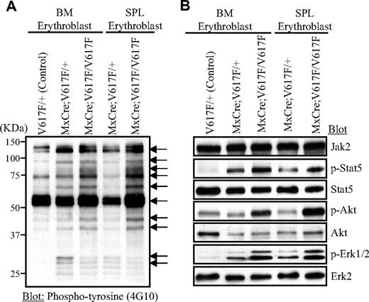 Figure 6. Signaling effects of heterozygous and homozygous Jak2V617F in erythroid progenitors. Primary erythroblasts were derived from the BM and spleen of control (V617F/+), heterozygous, and homozygous Jak2V617F mice. For signaling studies, erythroblasts were starved in Iscove modified Dulbecco medium plus 0.5% BSA for 4 hours. Cell lysates were prepared in radioimmunoprecipitation assay (RIPA) buffer and subjected to immunoblotting with anti-phosphotyrosine (4G10) antibody (A) or phospho-specific antibodies against Stat5, Akt, and Erk1/2 (B).