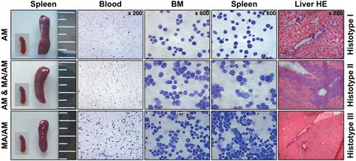 Figure 4. Histopathologic characterization revealed 3 histotypes associated with leukemia. All 3 histotypes are shown. Panels from left to right: spleen sizes (with an embedded picture of a control spleen), blood smears, cytospins of bone marrow (BM) and spleen, and liver sections after hematoxylin and eosin (HE) staining.