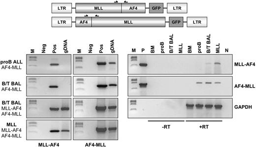 Figure 6. Molecular analyses revealed the presence and transcription of transgenes in leukemic cells. (Top) Scheme of both proviruses encoding the MLL·AF4 and AF4·MLL alleles. (Left panels) Genomic PCR experiments of 4 primary leukemic mice, displaying the results of leukemic cells that either encode the AF4·MLL transgene and developed a pro-B or a B/T BAL disease phenotype or that exhibit both t(4;11) fusion alleles and developed a B/T BAL or mixed lineage leukemia (MLL). Neg indicates negative control; Pos, positive control; and gDNA, genomic DNA isolated from the leukemic cells of indicated mice. (Right panels) RT-PCR analysis of 3 mice representing the pro-B, B/T BAL, and MLL leukemia disease phenotype. Appropriate controls (−RT) demonstrated that only cDNA derived from total RNA was investigated (+RT). Transcription of all transgenes was demonstrated. GAPDH indicates positive control for isolated RNA; P, PIDE::MLL·AF4 or PIDE::AF4·MLL plasmids served as positive controls; N, negative control; BM, bone marrow, wild type; and M, DNA size marker (lambda DNA, ClaI digested).