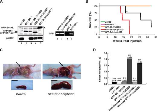 Figure 2. Ubiquitination-resistant Bfl-1ΔC induces massive splenomegaly when coexpressed with p53DD in nude mice. (A left) Western blot of FL5.12 cells stably expressing p53DD or GFP-Bfl-1 alone or coexpressing p53DD with either GFP-Bfl-1, GFP-Bfl-1ΔC or GFP-Bcl-xL. (Right) Reverse transcriptase polymerase chain reaction shows equivalent amounts of GFP-Bfl-1 and GFP-Bfl-1ΔC mRNA in FL5.12 cell lines stably expressing GFP-Bfl-1/p53DD, GFP-Bfl-1ΔC/p53DD, or GFP-Bfl-1 alone. (B) Kaplan-Meier curves showing overt manifestation of disease in athymic nude mice (Balb/c nu+/nu+) injected intravenously with FL5.12 cells expressing p53DD alone (green), GFP-Bfl-1 alone (purple), GFP-Bfl-1/p53DD (orange), GFP-Bfl-1ΔC/p53DD (red), or GFP-Bcl-xL/p53DD-positive control (black). The arrowhead denotes a mouse that died of unknown cause. P values were determined by Student t test (GFP-Bfl-1ΔC/p53DD vs p53DD or GFP-Bfl-1 or GFP-Bfl-1/p53DD, P = .001; GFP-Bfl-1ΔC/p53DD vs GFP-Bcl-xL/p53DD, P = .042). (C) Splenomegaly in a representative GFP-Bfl-1ΔC/p53DD mouse compared with p53DD alone. Scale bar, 1cm. (D) Plot of average spleen weight at euthanasia.