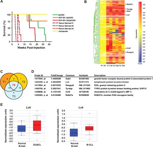 Figure 5. Splenocytes recovered from diseased Bfl-1ΔC/p53DD mice are tumorigenic and display up-regulation of Lck and RANK signaling pathway. (A) Kaplan-Meier curves show accelerated tumorigenesis in nude mice transplanted with splenocytes derived from 3 independent Bfl-1ΔC/p53DD mice (GFP-Bfl-1ΔC/p53DD vs tumor derived 1, P = .001; GFP-Bfl-1ΔC/p53DD vs tumor-derived 2, P = .001; GFP-Bfl-1ΔC/p53DD vs tumor derived 3, P = .001). Uninjected mice and mice injected with FL5.12 cells expressing p53DD alone, GFP-Bfl-1/p53DD, or parental FL5.12 cells expressing Bfl-1ΔC/p53DD served as controls. The arrowhead denotes a mouse that died of unknown cause. (B) Hierarchical clustering of genes up- or down-regulated 2-fold or greater in microarrays from 3 independent GFP-Bfl-1ΔC/p53DD tumors analyzed in duplicate experiments with the use of 2 different cell lines isolated from each tumor (eg, T1 vs T1A) versus parental FL5.12 cells expressing GFP-Bfl-1ΔC/p53DD. Data were normalized with the use of GeneSpring 7.2 analysis software. (C) Venn diagram representing genes up-regulated by 2-fold or greater in GFP-Bfl-1ΔC/p53DD tumors. (D) Selected genes commonly up-regulated in 3 independent GFP-Bfl-1ΔC/p53DD tumors versus parental cells. (E) Box plots showing significant up-regulation of Lck mRNA in primary specimens from human diffuse large B-cell lymphoma (DLBCL) and B-cell chronic lymphocytic leukemia (B-CLL) compared with normal B cells (Rosenwald dataset), as extracted from the Oncomine database.