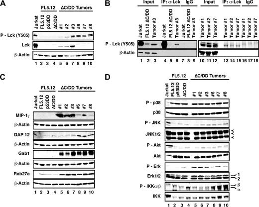 Figure 6. Lck and proteins in the RANK signaling pathway are significantly up-regulated in Bfl-1ΔC/p53DD tumor-derived cells. (A) Western blots show increased levels of Lck and phospho-Lck in splenocytes from mice injected with FL5.12 cells expressing GFP-Bfl-1ΔC/p53DD versus parental FL5.12 GFP-Bfl-1ΔC/p53DD cells. The blot was probed with anti–phospho-Src/Lck, anti-Lck, or anti–β-actin. FL5.12 cells and FL5.12 cells expressing p53DD alone were negative controls; Jurkat T-cells are a positive control for Lck (1/5 input). (B) Immunoprecipitation of GFP-Bfl-1ΔC/p53DD-tumor-derived cells from mice 1, 2, 3, and 7 with anti-Lck, followed by Western blot with anti–phospho-Src-Lck. (C) Western blot showing elevated levels of MIP-1γ, DAP12, Gab1, and Rab27a in splenocytes derived from the mice analyzed in panel A. (D) Western blots show activation of the Akt, ERK, and IKK signaling pathways in splenocytes derived from the mice analyzed in panel A, as seen with anti-phospho p38, JNK, Akt, ERK, or IKK.