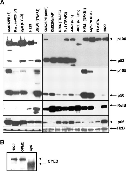 Figure 1. Steady-state levels of components of the NF-κB pathway in MM cells. (A) Steady-state levels of NF-κB subunits in nuclear-enriched protein fraction from MMCLs. Nuclear extracts were prepared, and expression of the proteins indicated at right was analyzed on immunoblots: known and unknown (?). NF-κB mutations for MMCLs with high NF-κB index are indicated in parentheses. (B) Immunoblot for CYLD in MMCLs.