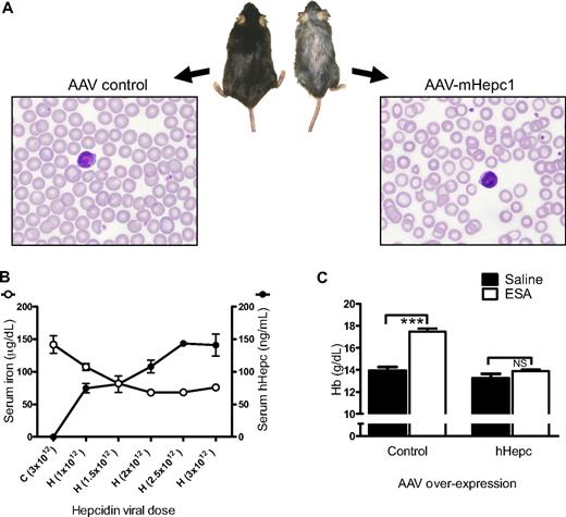 Figure 1. Hepcidin overexpression caused iron-limited erythropoiesis. (A) Photograph of gross appearance and Wright-Giemsa–stained peripheral blood smear of representative C57BL/6 mice 4 months after viral transduction (AAV8) with AAV-mHepc1 (1.3 × 1013 particles/mouse) or AAV control (empty-vector: 8 × 1012 particles/mouse). Overexpression of mHepc1 resulted in runted growth, hair loss, and microcytic, hypochromic anemia. Gross appearance of mice was captured using a standard digital camera and brightness adjusted using Microsoft PowerPoint. Peripheral blood smears were visualized using a Nikon ECLIPSE E600 microscope with a Nikon Plan Fluor 100×/1.30 NA oil objective. Images were captured using a Nikon Digital Camera DXM 1200f (Nikon) and processed using Nikon's ACT-1 Version 2.62 software. (B) AAV-hHepc expression in mice (AAV5; n = 4/group) caused an increase in serum levels of hHepc and a dose-dependent decrease in serum iron 2 weeks after viral transduction. H indicates AAV-hHepc; C, AAV-control (AAV-GFP). Infectious units administered via tail vein injection are shown in parentheses. (C) Control animals (AAV-GFP) responded to suprapharmacologic ESA treatment, whereas animals overexpressing hHepc did not show a significant Hb response (ESA administered 4 weeks after virus treatment as in panel B and Hb measured 1 week later; n = 4-5/group). Horizontal bars indicate groups compared for statistical analysis: ***P < .001; NS, no significance. Results in all figures are shown as mean ± SEM.