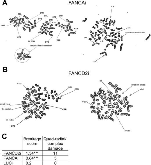 Figure 3. FANCD2i and FANCAi hESCs exhibit increased chromosomal breakage and radial formation upon MMC treatment. (A-B) Representative metaphase spreads from FANCAi and FANCD2i hESCs after treatment with 200nM MMC for 24 hours. DEL indicates deletion; CTB, chromatid break; CTG, chromatid gap; and CSB, chromosome break. (C) Quantification of total damage/cell (additional details on breakage score calculation in “Chromosomal breakage analysis”) and quadriradials/complex damage (ring structures, extensive chromosomal breakage/rearrangement precluding precise quantitation) for 50 scored metaphases. ***P < .01 by χ2 test.