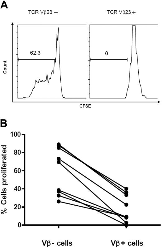 Figure 5. Proliferation of TCRVβ+ versus TCRVβ− cells. (A) Representative histogram plots of CFSE-labeled cells after 4 days of culture stimulated at a bead to cell ratio of 1:10, demonstrating the low number of TCRVβ+ cells that proliferated. (B) Scatterplot of percentage of cells that proliferated in TCRVβ+ versus TCRVβ− cells for 9 different expansions (t = 7.73; P < .001).