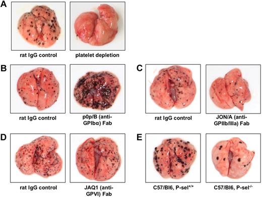 Figure 2. Examples for modulation of pulmonary melanoma metastasis through targeted interference with platelet receptors. In all experiments (performed by L.E. in the laboratory of M.P.S.), C57/BL6 mice were intravenously injected with 2.5 × 105 B16F10 melanoma cells, and pulmonary metastasis was evaluated after 10 to 14 days. (A) Antibody-mediated depletion of platelets prevents metastasis formation. (B) Inhibition of platelet GPIbα by function-blocking, monovalent Fab fragments results in a marked increase of pulmonary melanoma metastases. (C) Inhibition of GPIIb/IIIa by specific Fab fragments decreases the number of metastatic melanoma nodules in the lung. (D) Antibody-mediated blockade of GPVI does not significantly influence pulmonary melanoma metastasis. (E) P-selectin deficiency causes marked reduction of pulmonary melanoma metastasis.